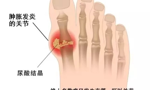 胃癌吃靶向药还用化疗吗-【胃癌靶向药需要吃多长时间】胃癌靶向药用后的反应是什么 - 胃癌靶向药用后的反应网